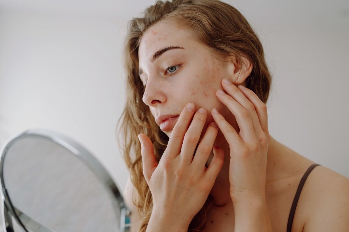 Welke skincare ingrediënten kunnen je huid irriteren en wat kun je dan doen?